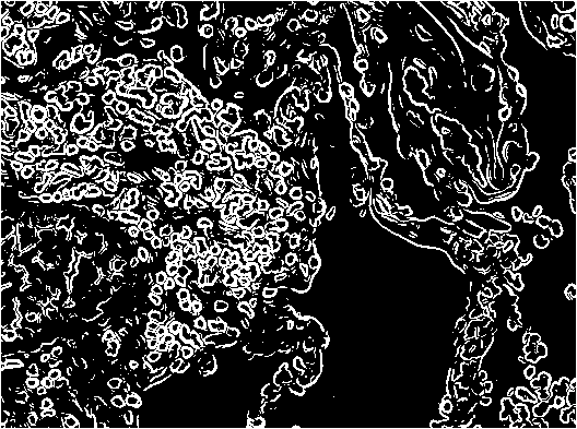 Gradient Segmented