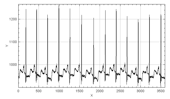 dimensionless ECG curve