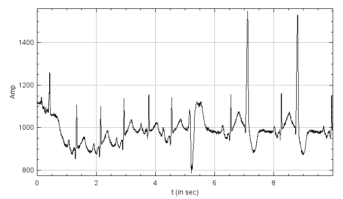 ECG curve