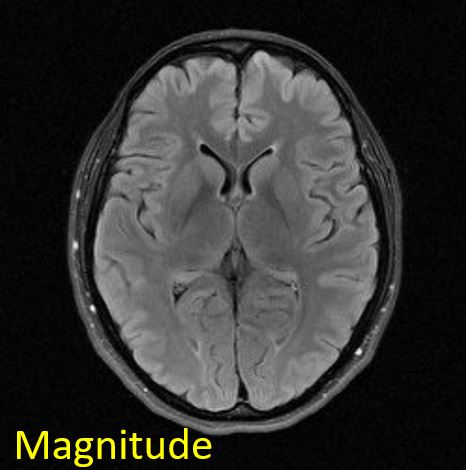 fig310-img_mag.jpg
