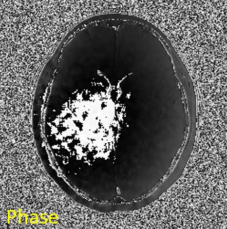 fig310-img_phase.jpg