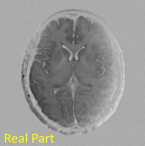 fig310-img_real.jpg